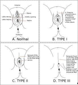 双性生殖器图片