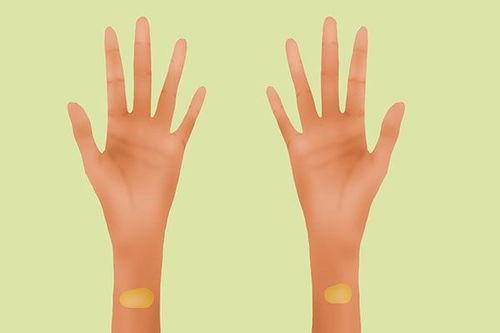 女生后背淤青图片,揭秘女生后背淤青之谜